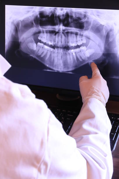 Best Emergency Dental Care for Broken or Chipped Teeth in Fruitvale, CO