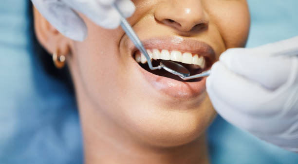 Best Emergency Gum Treatment in Fruitvale, CO