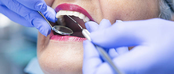 Best Urgent Care for Lost Fillings or Crowns in Fruitvale, CO